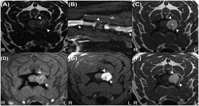 Case report: MRI and CT imaging features of a melanocytic tumour affecting a cervical vertebra in an adult dog, and review of differential diagnosis for T1W-hyperintense lesions